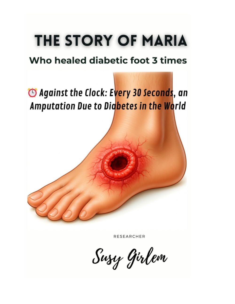 THE STORY OF MARIA, Who healed Diabetic foot 3 times: History of Healing and Care That Proved Effective for Diabetic Ulcers
