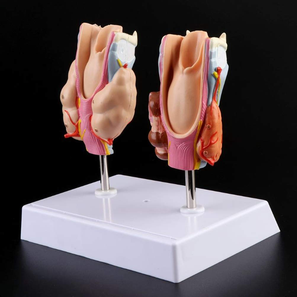 Model Anatomiczny Patologii Ludzkiej Tarczycy-Szyja Modelka Tarczycy, Model Anatomii Ludzkiej Medycznych Materiałów Dydaktycznych