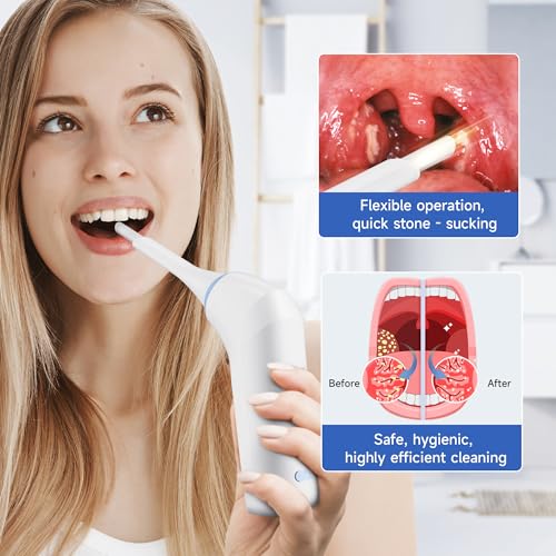 Image of Electronic Tonsil Stone Remover, Vacuum Tonsil Stone Removal Kit with LED Light, 3 Suction Modes, Tonsil Stone Cleaner Tool, Oral Care for Mouth Health, USB Rechargeable (White 2)