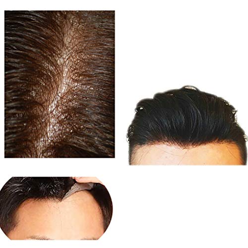 Hairnotion Invisible Mens Hair Replacement System Super Thin Skin 7# Toupee Wig for Men 8x10 Inch - Image 4