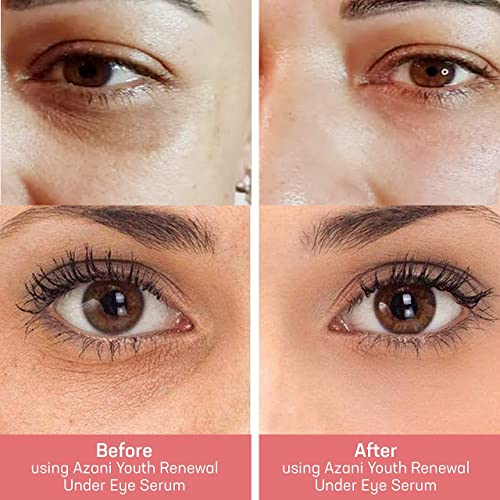 Youth Renewal Under Eye Serum By Azani | For Dark Circles, Puffiness, Eye Bags, Crows Feet, Fine Lines & Sagginess | 0.2% Retinol + Caffeine | Anti-Aging Eye Serum- 0.5 Oz | Women & Men #TOP5