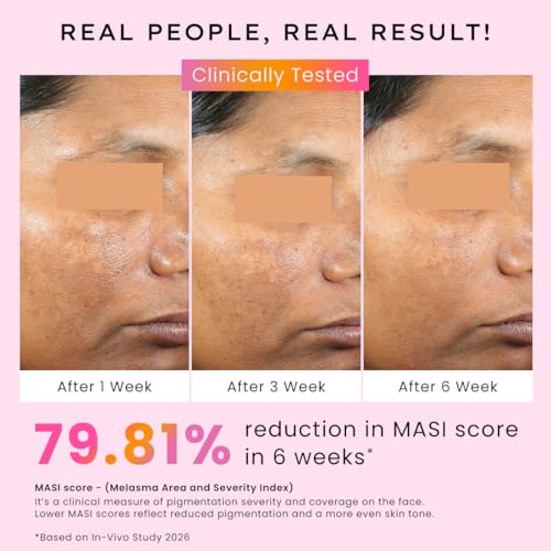 Image of Hyphen 4% Tranexamic Acid + 5% Niacinamide Biphasic De-Pigmentation Serum | Correction & Prevents Hyperpigmentation, Dark Spots & Melasma| In-vivo tested & Non-Comedogenic| Deep Penetration - 30 ml