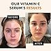 Eclat Skincare Vitamin C Face Serum - Skin Care for Dark Spots, Vitamin C Serum with Hyaluronic Acid, Ferulic Acid, & Vit E - Anti Aging and Skin Brightening, Pure Vit C Facial Care - 30 ml