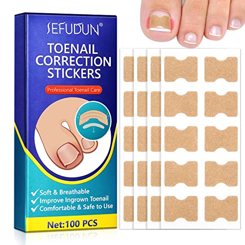 Toenail Correction Patch, 100 Pezzi Unghie Incarnite Piedi Adesivi Correzione Delle Unghie, Correttore Unghie dei Piedi Incarnite, Raddrizzante Strumento per Il Trattamento Delle Unghie Incarnite