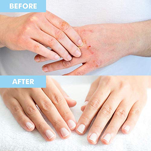 Bodipure Premium Keratin Gloves And Socks For Hydrating Dull Dry Hands And Cracked Heels – Callus Softening – Nail Strengthening – Skin Brightening And Nourishing – 3 Pairs Ea. (3+3 Pack) #TOP4