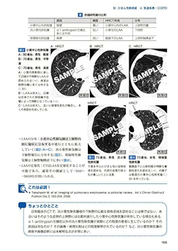 ビギナーのための胸部画像診断 Q&amp;Aアプローチ ビギナーのための胸部画像診断 Q&Aアプローチ | 髙橋 雅士 |本