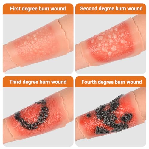 Image of Burn Wound Packing Trainer, Burn Moulages Kit, Adhesive Skin Burn Wound Trainer for Wound Care Training, Burn Wound Training Model