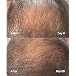 SickScience PowerCycle Exosome Hair Growth Serum - Clinically Advanced Scalp Treatment for Thinning Hair, Hair Loss Prevention & Regrowth - Lightweight Formula for Women & Men, Without Minoxidil, 60mL - Image 5