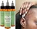 BeanStalk Hair Loss Treatment: Promotes Fast Hair Growth in 2 Weeks