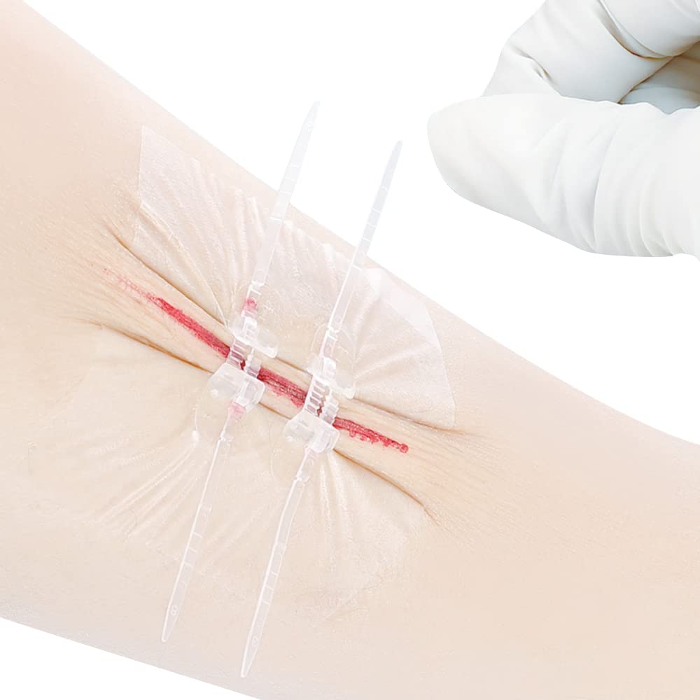 Buy Wound Closure Strips,2pcs Butterfly Bandaids Laceration Closures