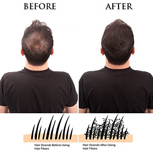 Immetee IMMETEE001 Keratin Hair Building Fibers Powder Conceal Instantly thumb #5