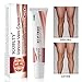 Varicose Veins Cream, Varicose Vein Treatment, Vein Cream for Spider Veins, Relief Phlebitis Angiitis Inflammation Blood Vein Veins Vasculitis Treatment Legs, Herbal Care Ointment Relief Phlebitis