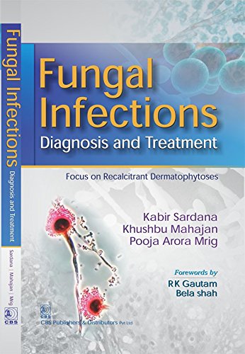 Buy Fungal Infections Diagnosis And Treatment Book Online at Low Prices ...
