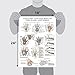 Palace Learning Laminated Anatomy and Injuries of the Hand and Wrist Poster - Hand and Wrist Joint Anatomical Chart - 18
