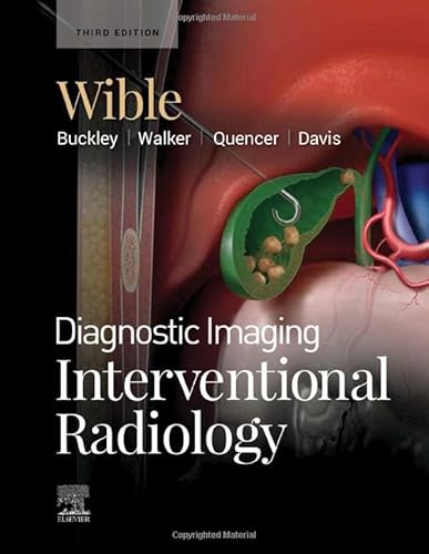 Diagnostic Imaging: Interventional Radiology #TOP16