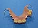 Denture Repair Lab - Repair Broken Denture - Cracked Denture Repair