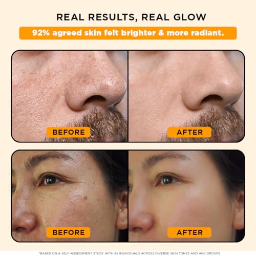 Image of Orgatre 24k Gold Dust Peel Off Mask | Glowing Skin & hydrating, Boosts Collagen and Restoring Skin Radiance | For All Skin Types | For Men & Women | 100ml