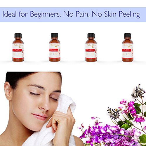 Lactic Acid 50% Gel Peel Including After Peel Neutralizer Facial Peel Contains Retinol Vitamin C Kojic Acid Licorice Bearberry Tea Mulberry. Perfect Acne Treatment Fade Acne Scars Diminish Wrinkles