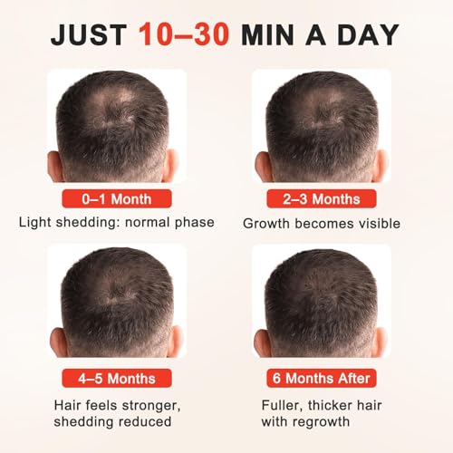 Image of Red Light Therapy for Hair Growth for Men & Women,Red Light Hair Growth Cap,Full-Scalp Coverage,At-Home Scalp Care, Father's Day Gift Idea,Blue Cap