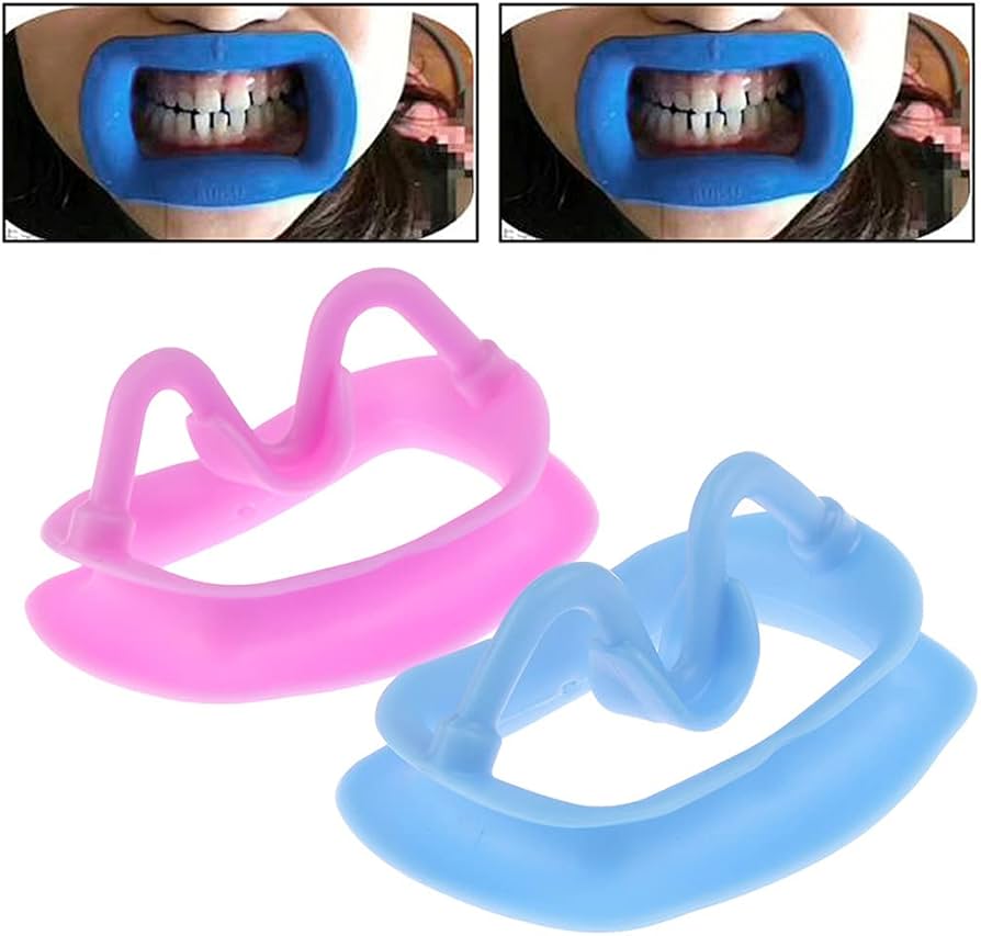 頬リトラクター 500個 歯科 マウスオープナー Amazon.co.jp: プロフェッショナル歯科リップ頬リトラクターマウス