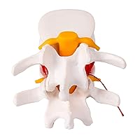 Vista 5 de Modelo de hernia de disco lumbar anatómica humana, modelo de hernia de disco lumbar de tamaño real - Modelo de columna lumbar para enseñar