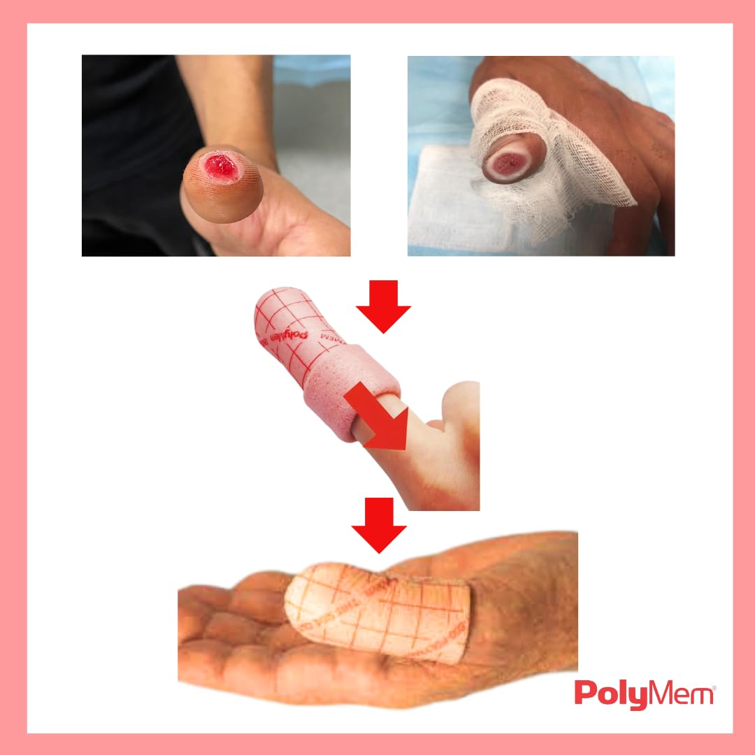 PolyMem Polymem 6 Apósitos especial para DEDOS Tamaño PEQUEÑO Minimiza el DOLOR producido por la herida a la vez que acelera el PROCESO DE CICATRIZACIÓN.
