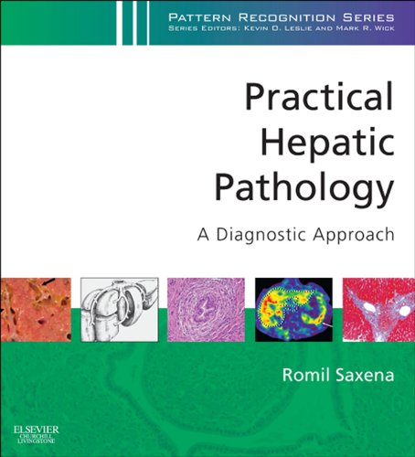 Practical Hepatic Pathology: A Diagnostic Approach: A Volume in the Pattern Recognition Series (English Edition)