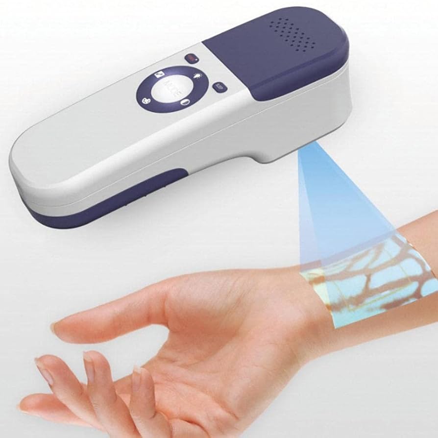 Amazon.com: ZWJABYY Vascular Vein Viewer,Led Vein Finder