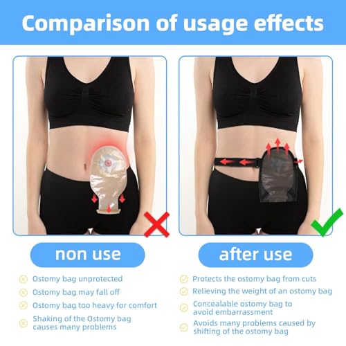 Ostomy Bag Cover,Waterproof Ostomy Bag with Adjustable Elastic Fixation Band Reusable Universal Stoma Pouch Cover Ostomy Supplies for ileostomy.