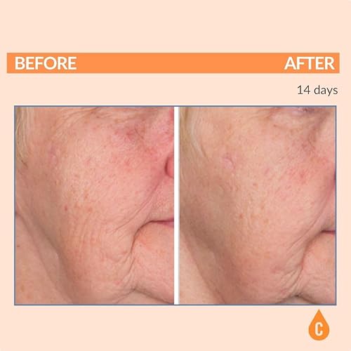 Miniatura 2 de Serious Skincare Suero de vitamina C para cara, suero facial antienvejecimiento con colágeno, vitamina E, cuidado hidratante de la piel para