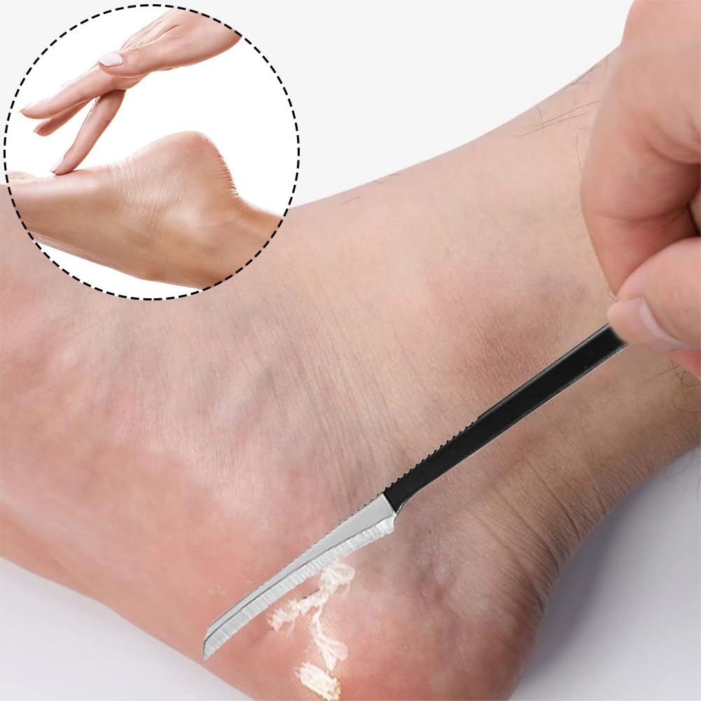 Cuchillo de Pedicura, Removedor de Callos Para Pies, Lima de Pie de Maíz de Piel, Cuchillo de Pedicura, Lima de Pie Raspador de Callos, Raspador Removedor de Callos de La Piel, Raspador de Pedicura
