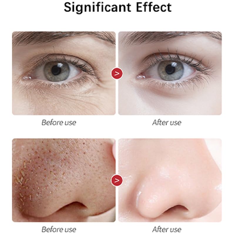 Miniatura 7 de YURHERSU Suero facial de vitamina C, esencia facial de ácido hialurónico, hidratante de larga duración, antienvejecimiento, antioxidante absorbe