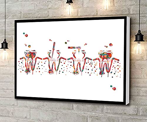 Canvas Wall Art Root Canal Procedure Watercolor Print Endontic Therapy Illustration Anatomy Art Poster Artwork Wall Art for Living Room Bedroom Bathroom Room Office Decor Framed 8''x12''