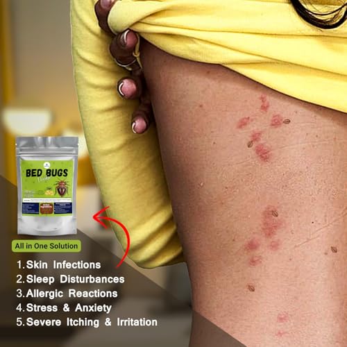 Image of Bed Bugs Killer Powder - Fast Acting Formula | Effective Bed Bug Treatment for Home, Mattress, Furniture & Luggage | Kills Bed Bugs & Eggs | Easy-to-Use Herbal Pest Control (40g)