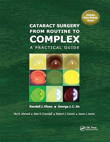 Cataract Surgery from Routine to Complex: A Practical Guide (English Edition)