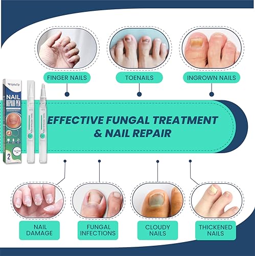 Extra Strength Nail Repair Pen – Restores Damaged, Thick or Discolored Nails with Natural Oils & Undecylenic Acid – Nail Support Formula – 2 Pack - Image 5