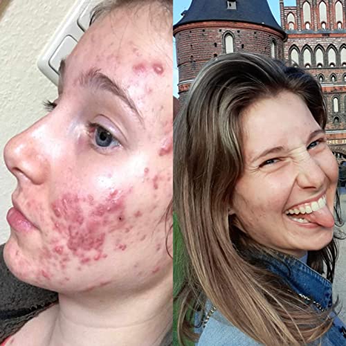 Die Pille, meine Psyche, die Kosmetikerin & Ich. mit #diekunstmühle.® cover art