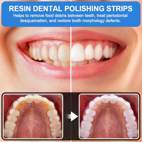 OFFCUP Zahn Schleifpapier, 3 Stück Dental Schleifstreifen 20μm+30μm+50μm Grit Size Interdental Schleifwerkzeuge Dental Polierstreifen Tragbare Zahnschleifpapier zum Polieren von Zähnen (6mx4mm)