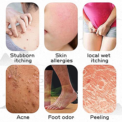 Natural Chinese Herbal Cream, Eczema Cream, Anti-Itch Cream, Dedicated for Dermatitis and Eczema Pruritus Psoriasis… - Afbeelding 6