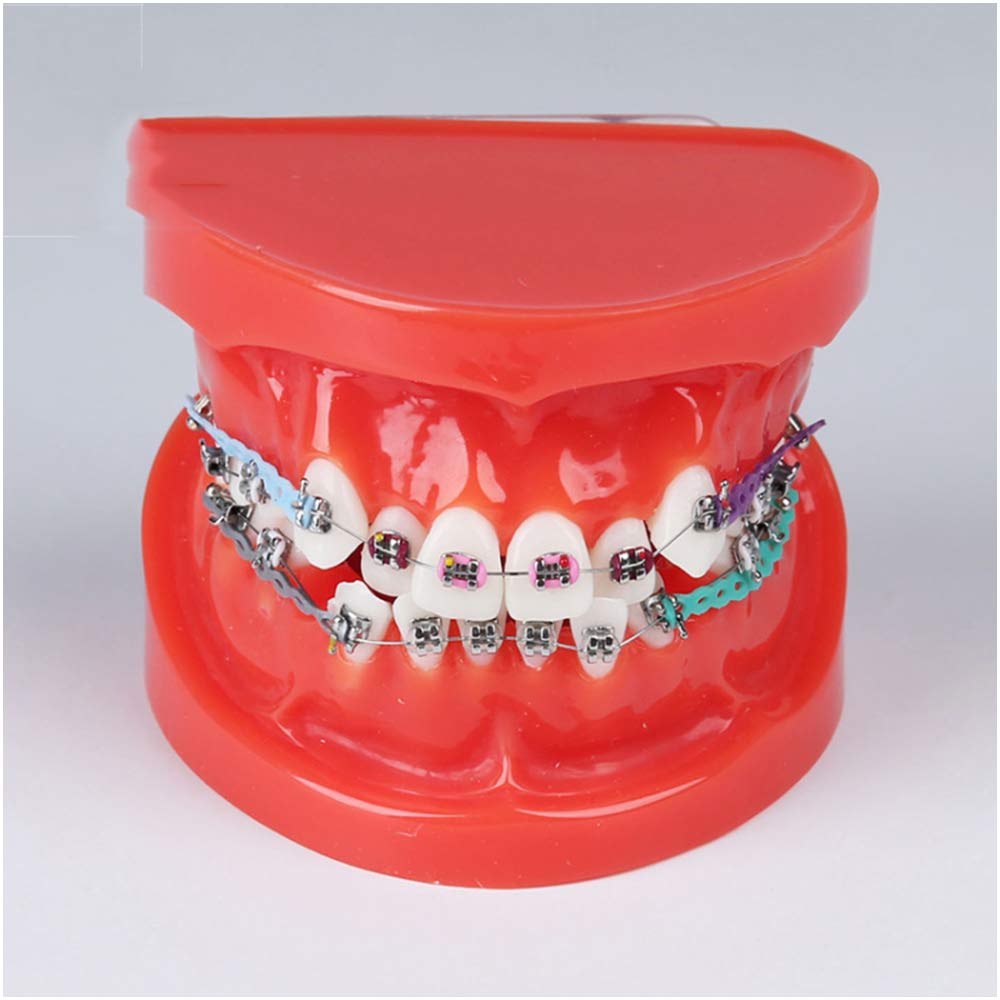 Sjdopulse A Teeth Teaching Model Orthodontic Model - Dental Malocclusion Orthodontic Treatment Dental Teeth Study Teaching Model Teeth Demonstration Model For Study Teaching (A)