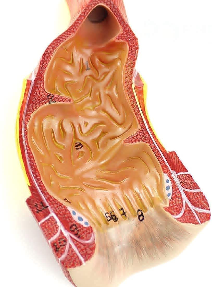 GTHTUHFD Anatomy Model, Educational Model Scientific Human Human Rectal Anal Canal Model Anorectal Surgery General Surgery Doctor For Medical Demonstration Skeleton Model
