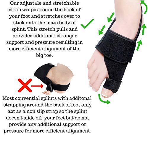 Bunion Corrector & Bunion Relief Kit, Bunion Splint, Big Toe Corrector Straightener Brace, Toe Separators Spacers Straighteners, Hammer Toe, Hallux Valgus, Toe Joint Pain Relief Aid for Men & Women