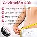 Radiofrecuencia Facial y Corporal Imagen de Radiofrecuencia Facial y Corporal