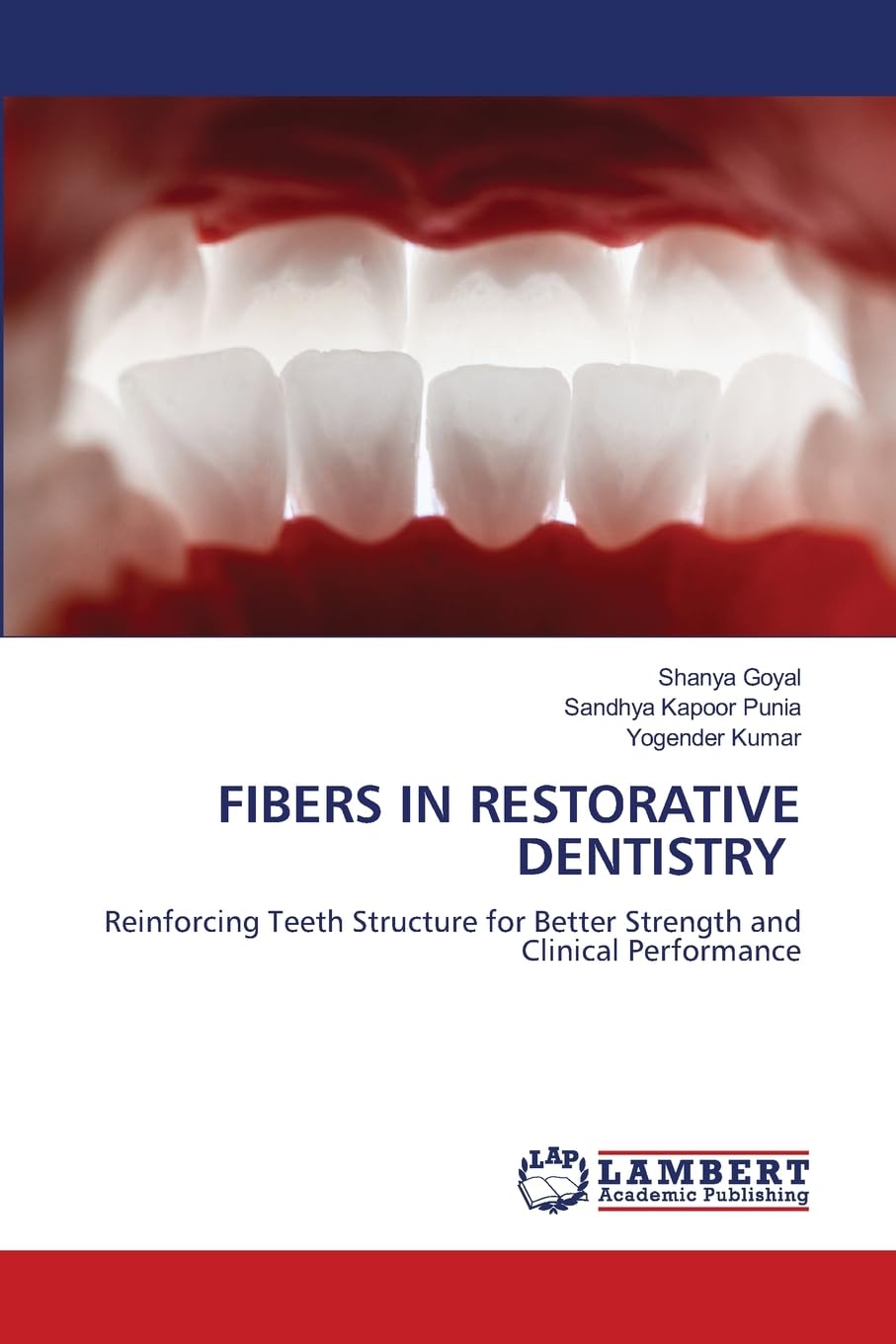 Fibers in Restorative Dentistry: Reinforcing Teeth Structure for Better Strength and Clinical Performance