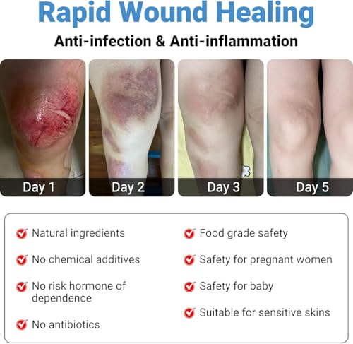 image for LMNOOP® Wound Healing Ointment for Chronic Care, Bedsores, Skin Ulcer
