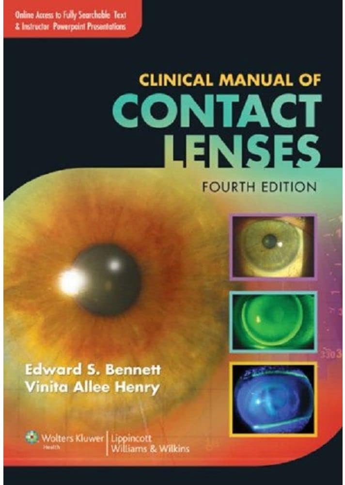 Clinical Manual of Contact Lenses