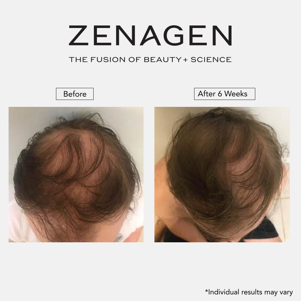 ZENAGEN Revolve Szampon zagęszczający dla mężczyzn, wspiera wygląd pełniejszych, zdrowiej wyglądających włosów, opracowany z myślą o delikatnych i wyraźnie przerzedzających się włosach, na bazie