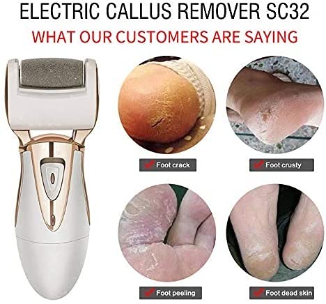 Removedor eléctrico de Callos para pies - Lima eléctrica para pies, Herramientas de pedicura con 2 Cabezales de Rodillos, lo Mejor para Pieles muertas secas y agrietadas