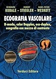 Verduci