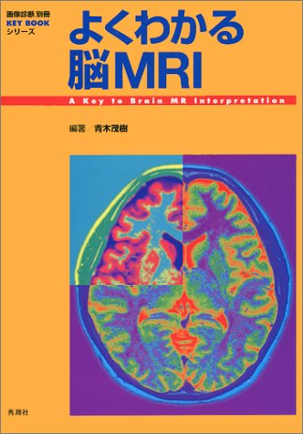 無料電子書籍 おすすめ よくわかる脳MRI (『画像診断』別冊KEY BOOKシリーズ) バイ